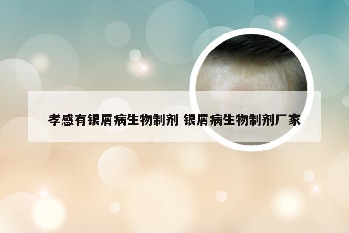 孝感有银屑病生物制剂 银屑病生物制剂厂家