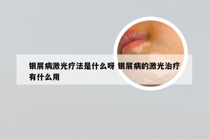 银屑病激光疗法是什么呀 银屑病的激光治疗有什么用