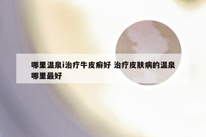 哪里温泉i治疗牛皮癣好 治疗皮肤病的温泉哪里最好