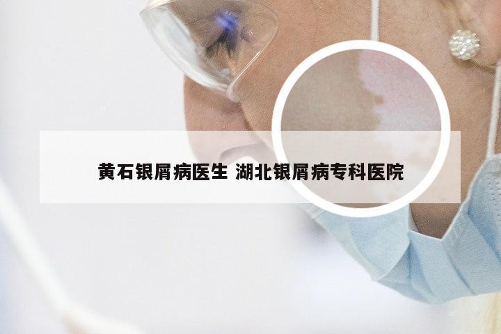 黄石银屑病医生 湖北银屑病专科医院