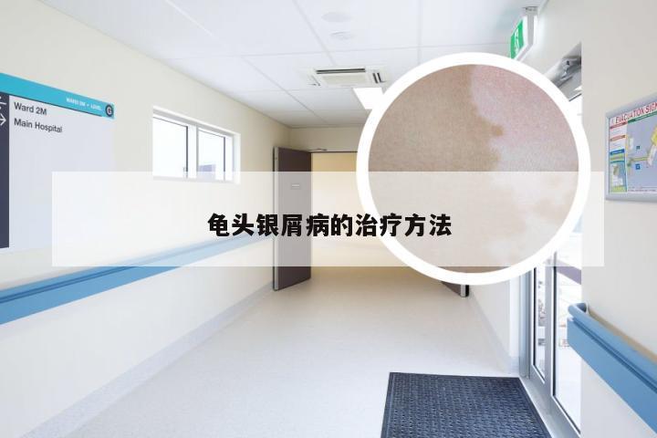 龟头银屑病的治疗方法