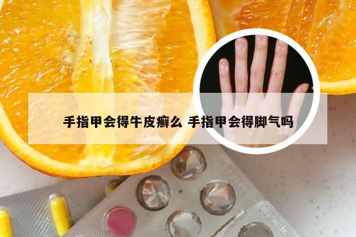 手指甲会得牛皮癣么 手指甲会得脚气吗