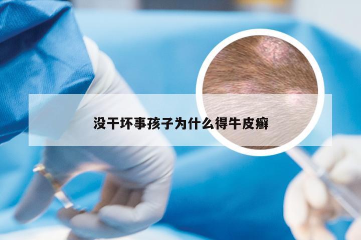 没干坏事孩子为什么得牛皮癣