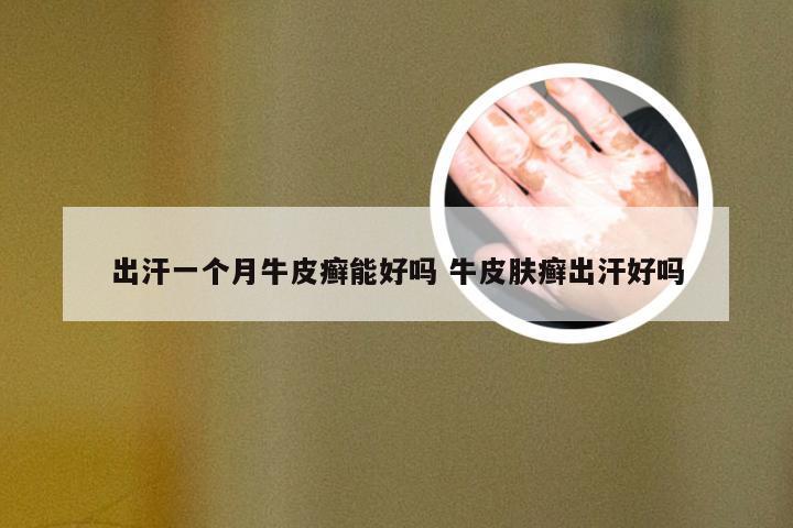 出汗一个月牛皮癣能好吗 牛皮肤癣出汗好吗