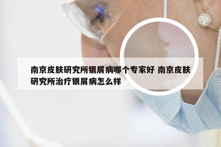 南京皮肤研究所银屑病哪个专家好 南京皮肤研究所治疗银屑病怎么样