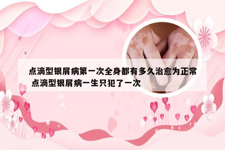 点滴型银屑病第一次全身都有多久治愈为正常 点滴型银屑病一生只犯了一次