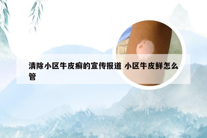 清除小区牛皮癣的宣传报道 小区牛皮鲜怎么管