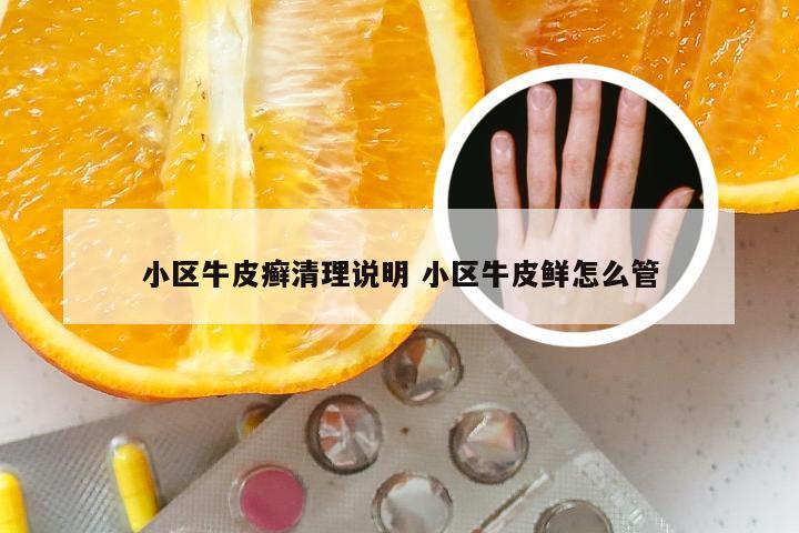 小区牛皮癣清理说明 小区牛皮鲜怎么管