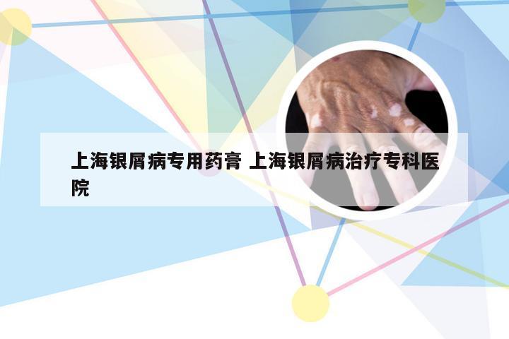 上海银屑病专用药膏 上海银屑病治疗专科医院
