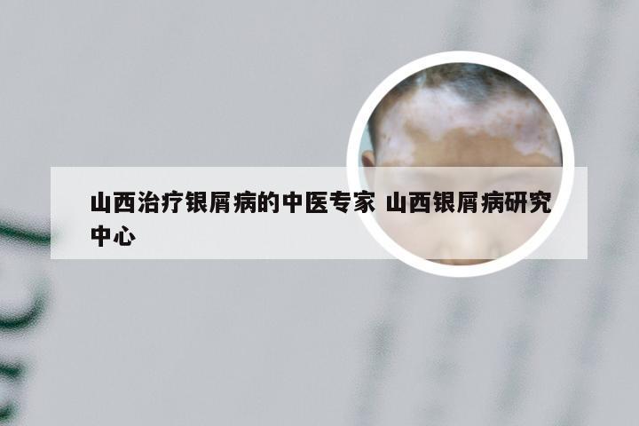 山西治疗银屑病的中医专家 山西银屑病研究中心