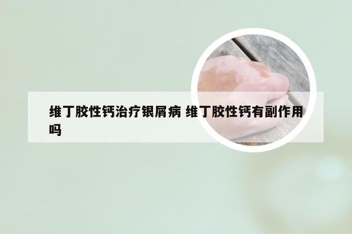 维丁胶性钙治疗银屑病 维丁胶性钙有副作用吗