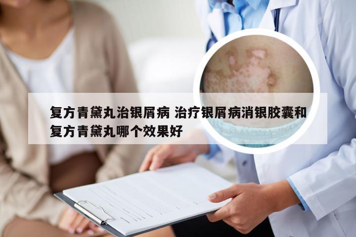 复方青黛丸治银屑病 治疗银屑病消银胶囊和复方青黛丸哪个效果好