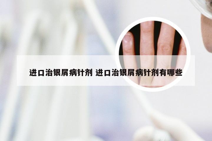 进口治银屑病针剂 进口治银屑病针剂有哪些
