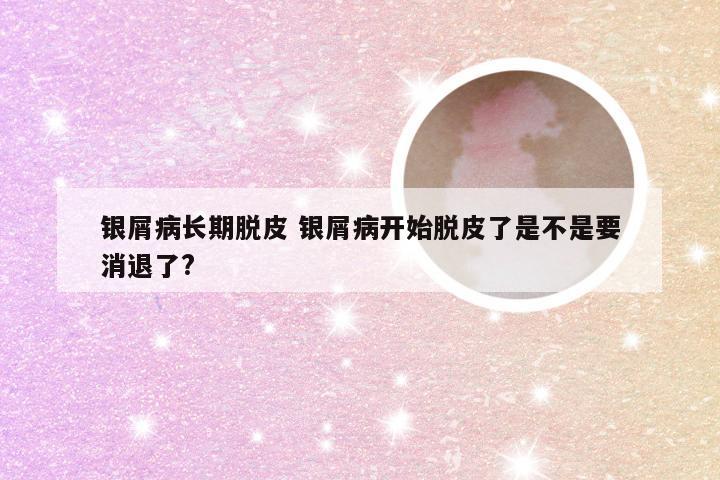 银屑病长期脱皮 银屑病开始脱皮了是不是要消退了?