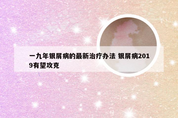 一九年银屑病的最新治疗办法 银屑病2019有望攻克