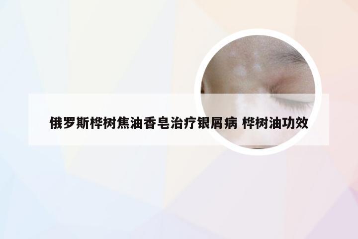 俄罗斯桦树焦油香皂治疗银屑病 桦树油功效