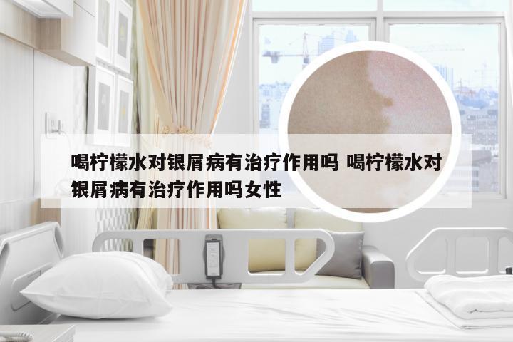 喝柠檬水对银屑病有治疗作用吗 喝柠檬水对银屑病有治疗作用吗女性