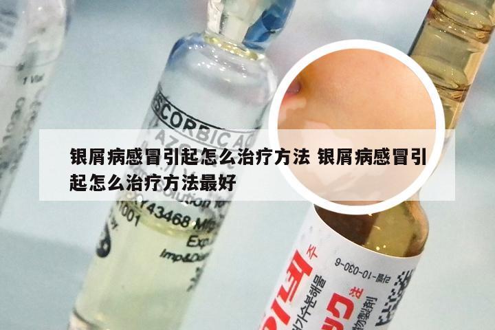 银屑病感冒引起怎么治疗方法 银屑病感冒引起怎么治疗方法最好