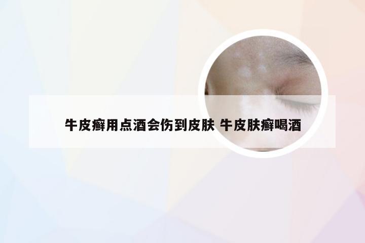 牛皮癣用点酒会伤到皮肤 牛皮肤癣喝酒
