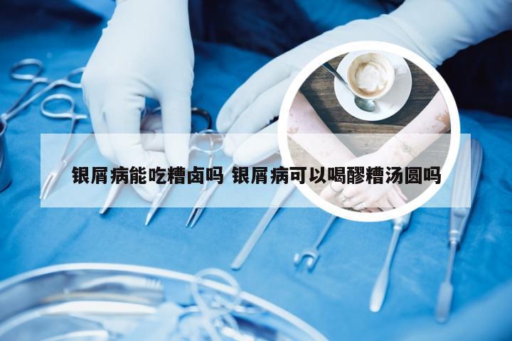 银屑病能吃糟卤吗 银屑病可以喝醪糟汤圆吗