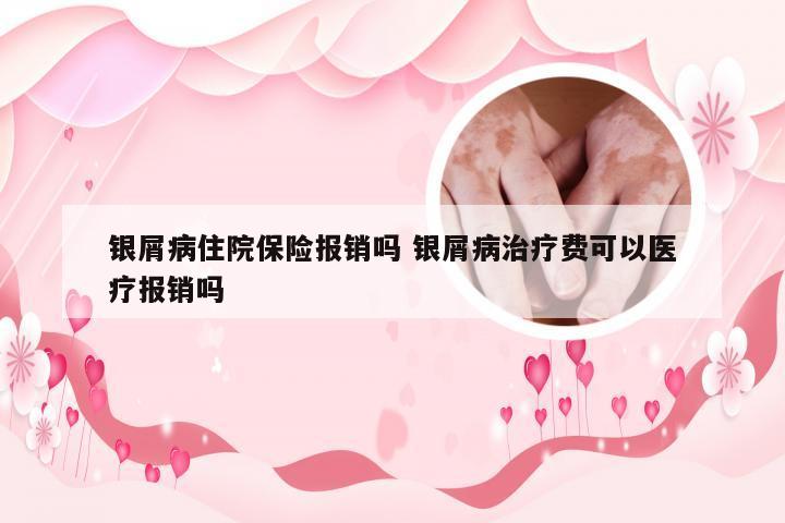 银屑病住院保险报销吗 银屑病治疗费可以医疗报销吗