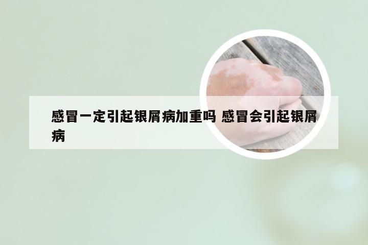 感冒一定引起银屑病加重吗 感冒会引起银屑病