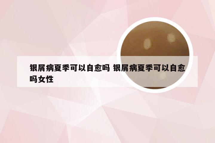 银屑病夏季可以自愈吗 银屑病夏季可以自愈吗女性