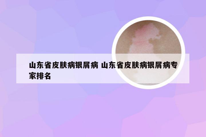 山东省皮肤病银屑病 山东省皮肤病银屑病专家排名