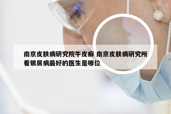 南京皮肤病研究院牛皮癣 南京皮肤病研究所看银屑病最好的医生是哪位
