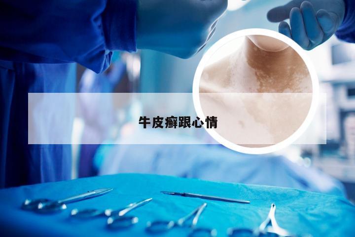 牛皮癣跟心情