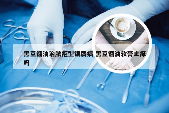 黑豆馏油治脓疱型银屑病 黑豆馏油软膏止痒吗