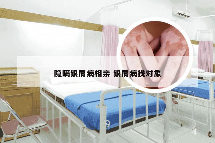 隐瞒银屑病相亲 银屑病找对象