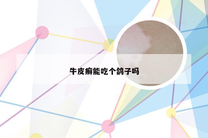 牛皮癣能吃个鸽子吗