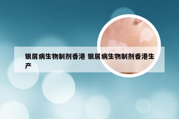 银屑病生物制剂香港 银屑病生物制剂香港生产