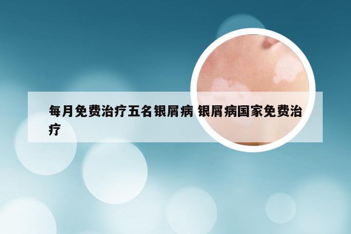 每月免费治疗五名银屑病 银屑病国家免费治疗