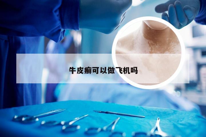 牛皮癣可以做飞机吗