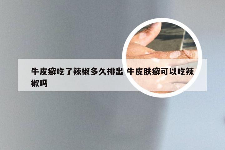 牛皮癣吃了辣椒多久排出 牛皮肤癣可以吃辣椒吗