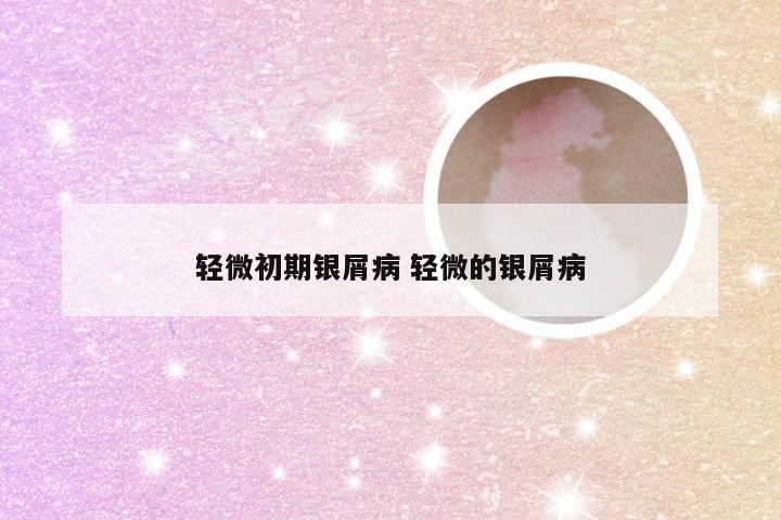 轻微初期银屑病 轻微的银屑病