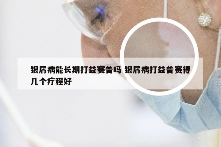 银屑病能长期打益赛普吗 银屑病打益普赛得几个疗程好