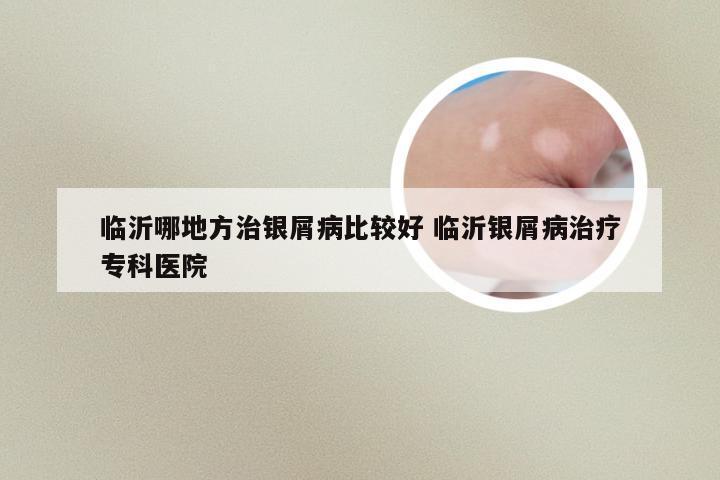 临沂哪地方治银屑病比较好 临沂银屑病治疗专科医院