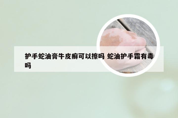 护手蛇油膏牛皮癣可以擦吗 蛇油护手霜有毒吗