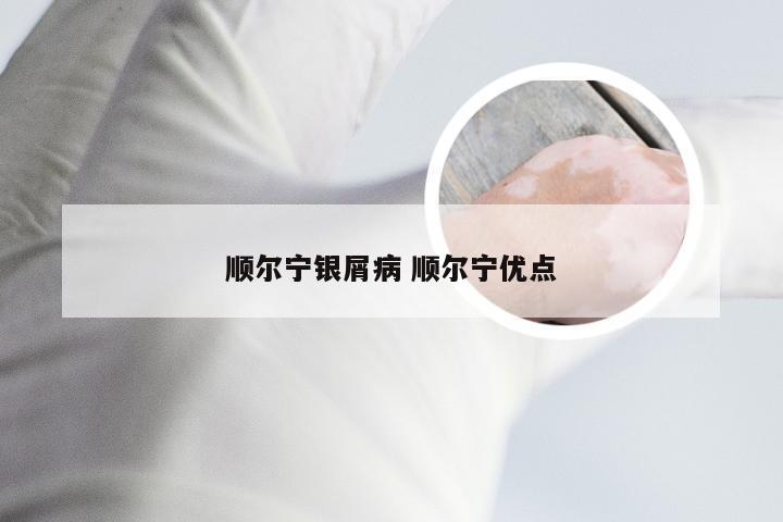 顺尔宁银屑病 顺尔宁优点
