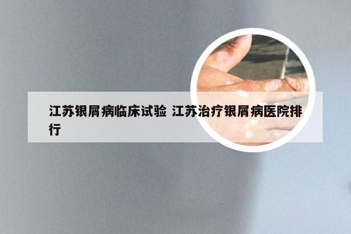 江苏银屑病临床试验 江苏治疗银屑病医院排行