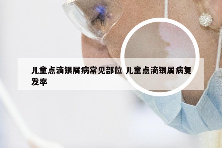儿童点滴银屑病常见部位 儿童点滴银屑病复发率