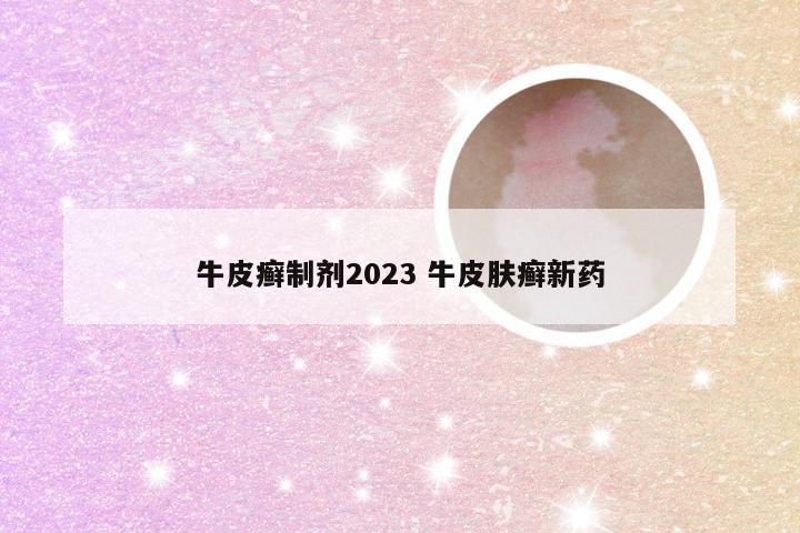 牛皮癣制剂2023 牛皮肤癣新药