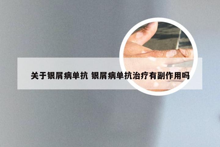 关于银屑病单抗 银屑病单抗治疗有副作用吗