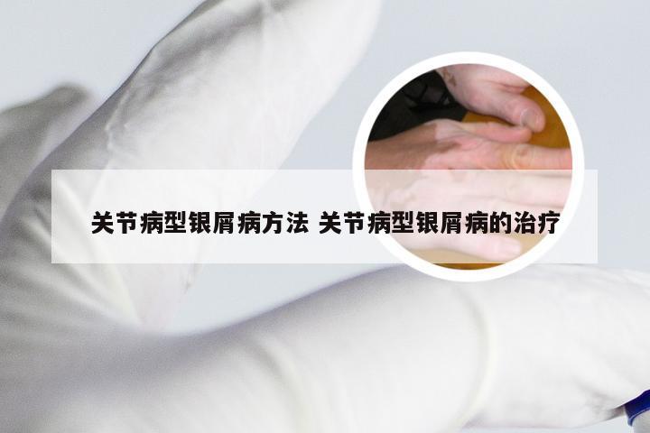 关节病型银屑病方法 关节病型银屑病的治疗