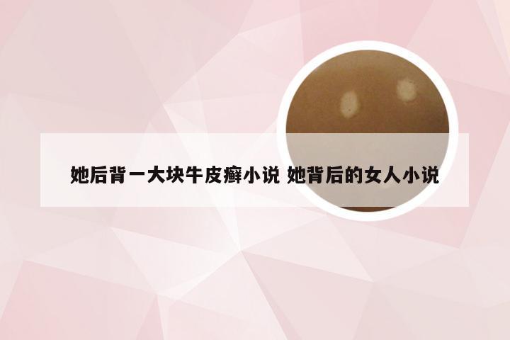 她后背一大块牛皮癣小说 她背后的女人小说