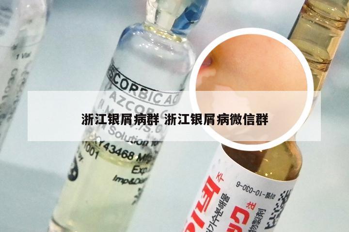 浙江银屑病群 浙江银屑病微信群