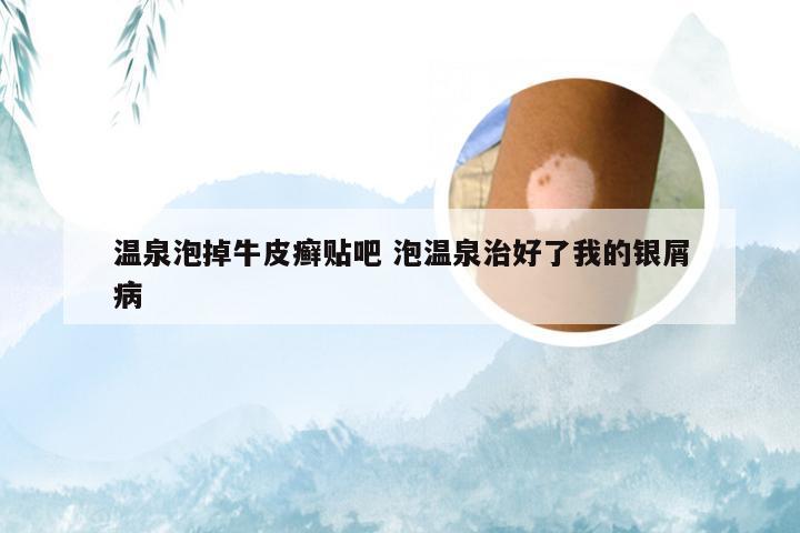 温泉泡掉牛皮癣贴吧 泡温泉治好了我的银屑病